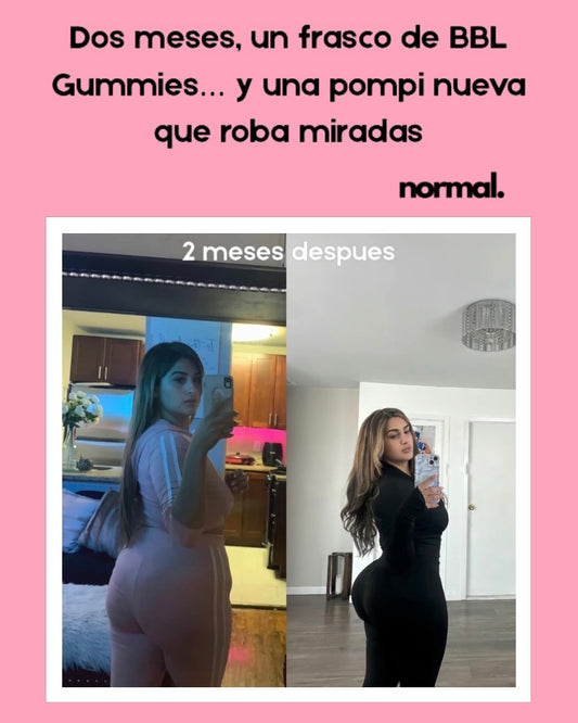 Gummies BBL - Normal. | 180 Gomitas Premium + 3 Meses